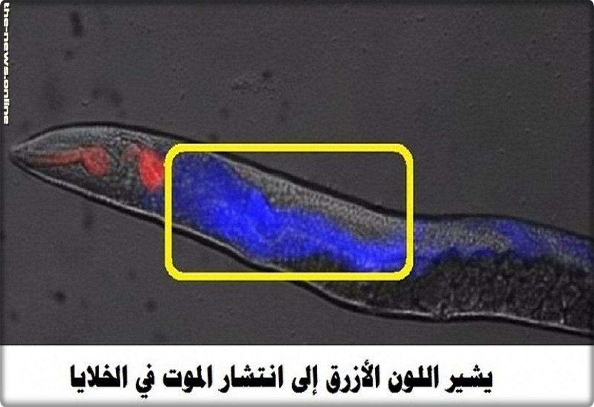 هكذا ينتشر الموت في جسم الإنسان، فيديو